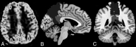 Fig 2.