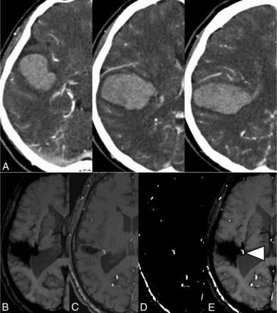 Fig 4.