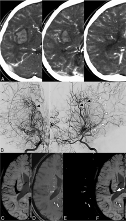 Fig 5.