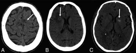 Fig 1.