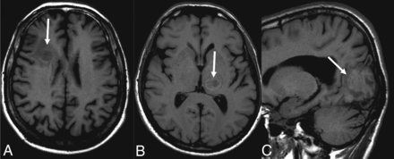 Fig 2.