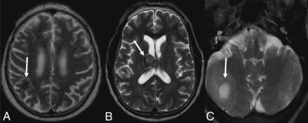Fig 3.