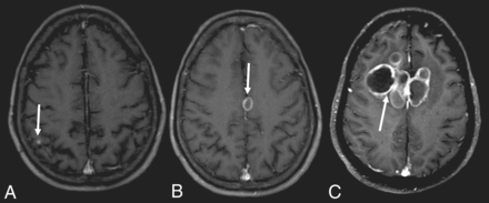Fig 5.