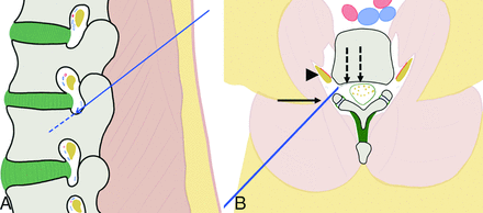 Fig 2.