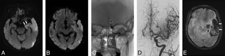 Fig 1.
