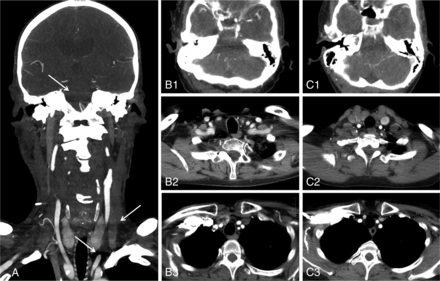 Fig 1.