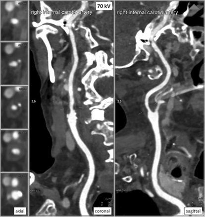 Fig 2.