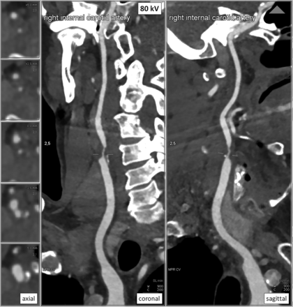 Fig 3.