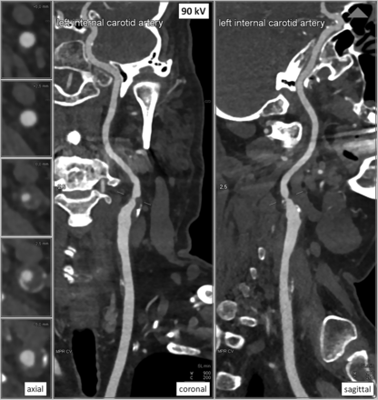 Fig 4.