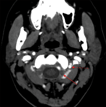 Fig 2.