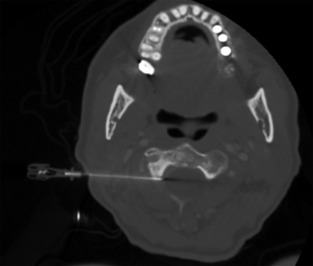 Fig 3.