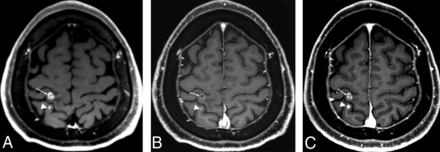 Fig 2.
