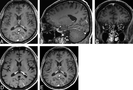 Fig 3.