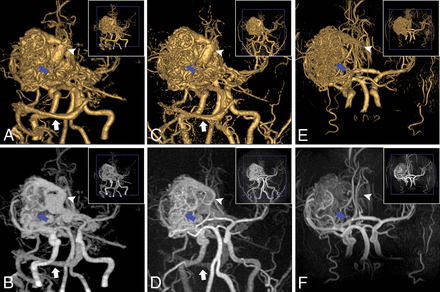 Fig 3.