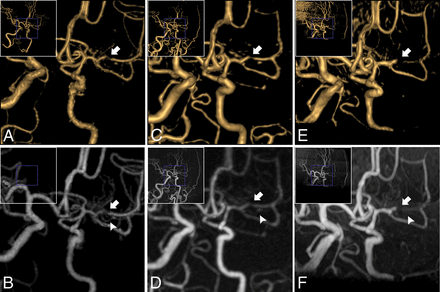 Fig 4.
