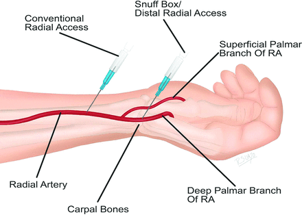 Fig 4.