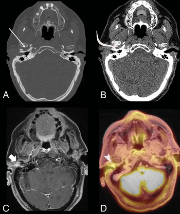 Fig 1.