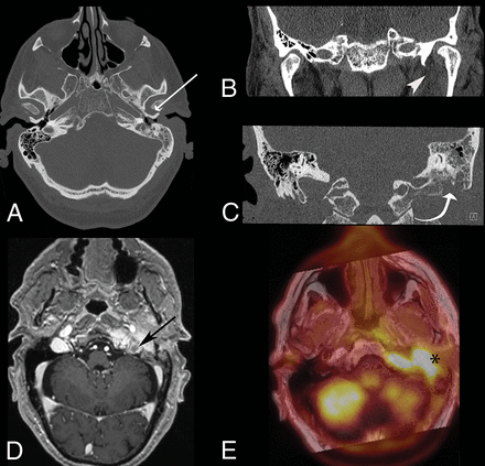 Fig 2.