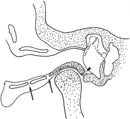 Fig 3.