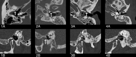 Fig 4.