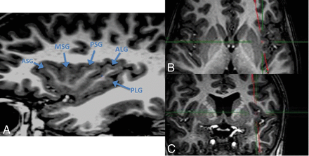 Fig 1.