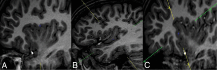 Fig 2.