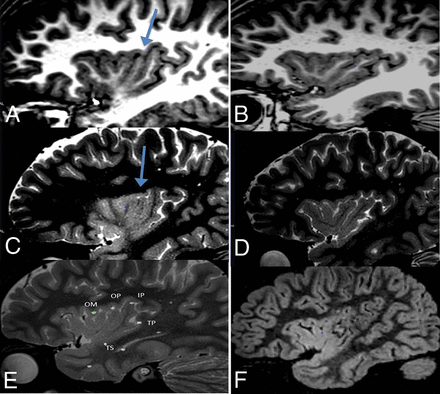 Fig 3.