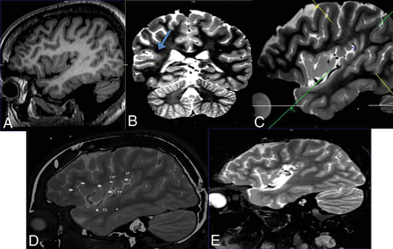 Fig 4.