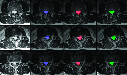 Fig 2.