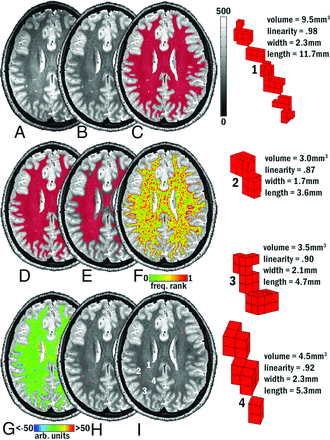 FIG 1.