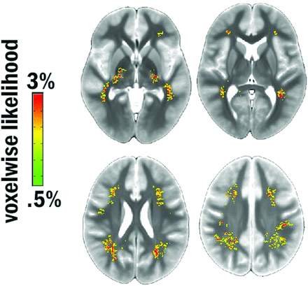 FIG 3.
