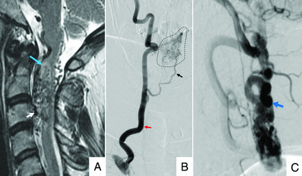 FIG 4.