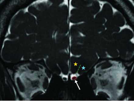 FIG 3.