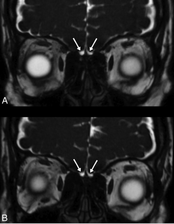 FIG 5.