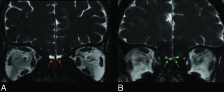 FIG 8.
