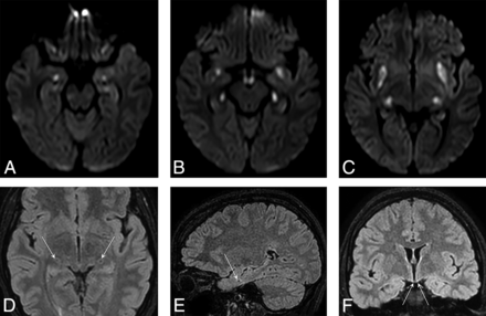 FIG 1.