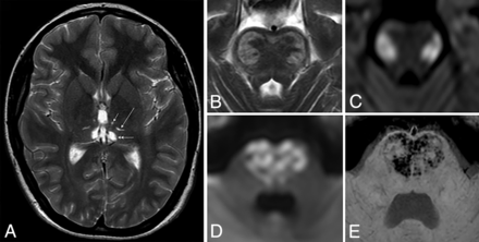 FIG 2.