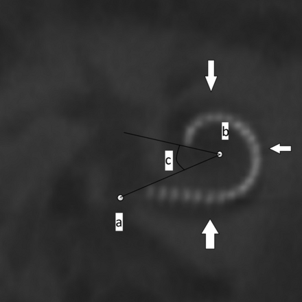 FIG 1.