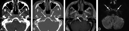 FIG 2.