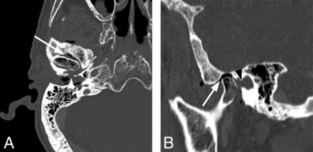FIG 4.