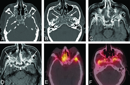 FIG 6.