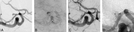 FIG 1.