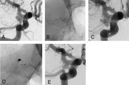 FIG 2.