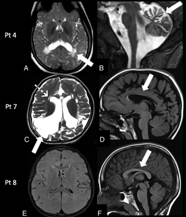 FIG 4.