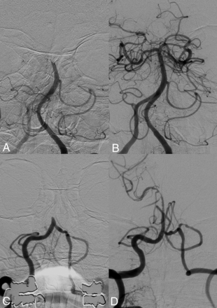 FIG 2.