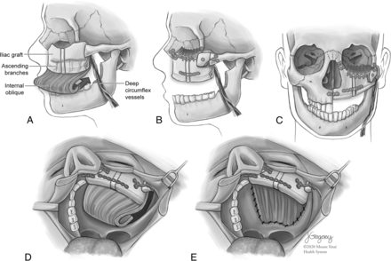 FIG 1.
