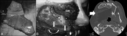 FIG 3.