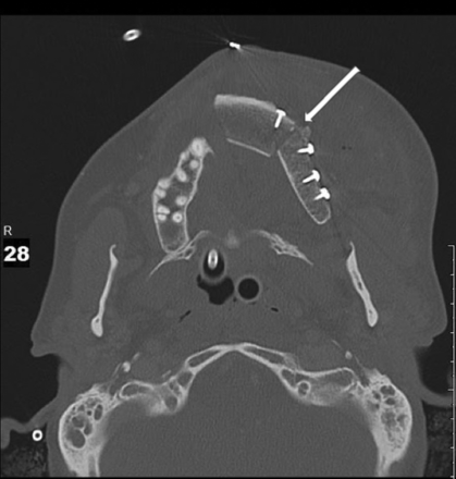 FIG 4.