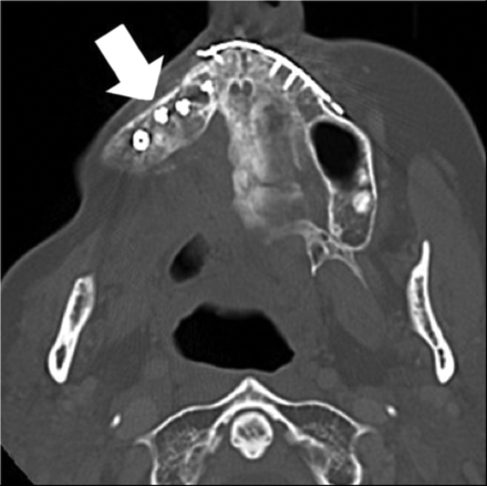FIG 5.