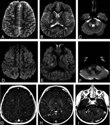 FIG 2.